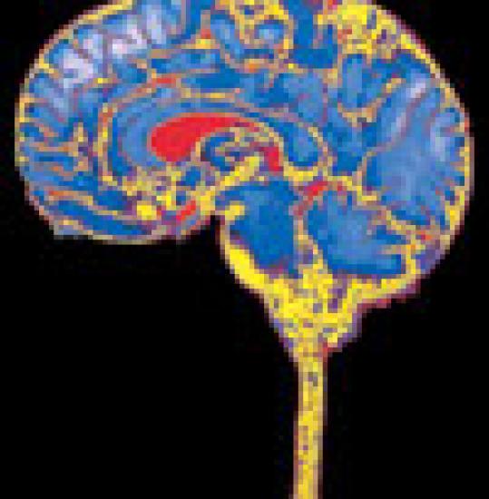 100x102l-s-brain.jpg