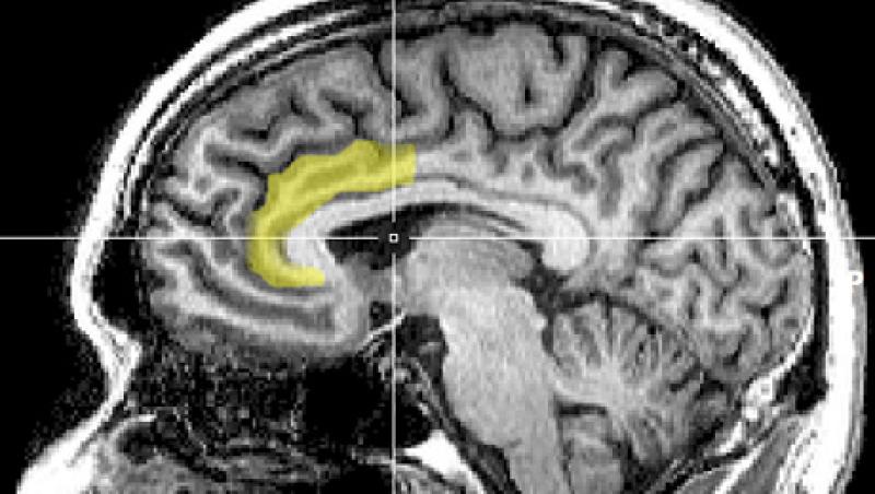 mri-large.jpg